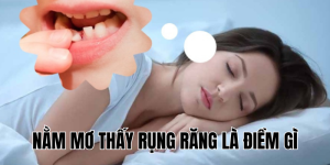 Nằm Mơ Thấy Rụng Răng Là Điềm Gì
